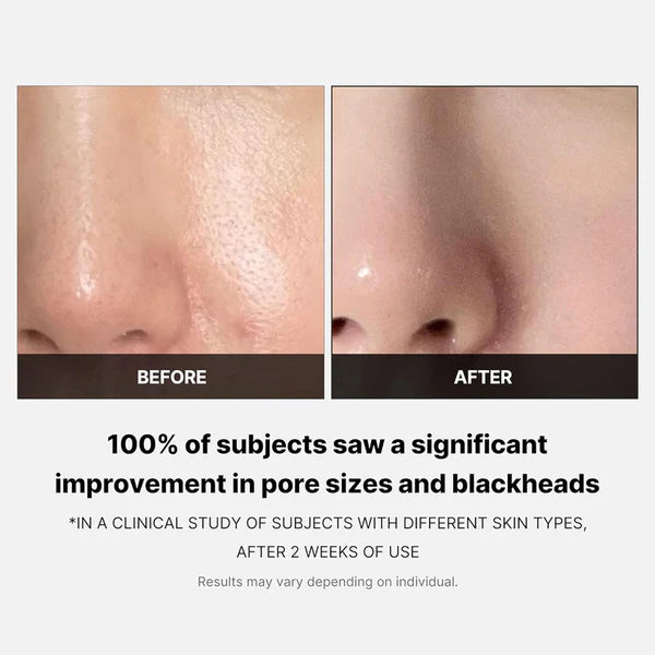 Medicube Zero Pore Pad 70 Pads