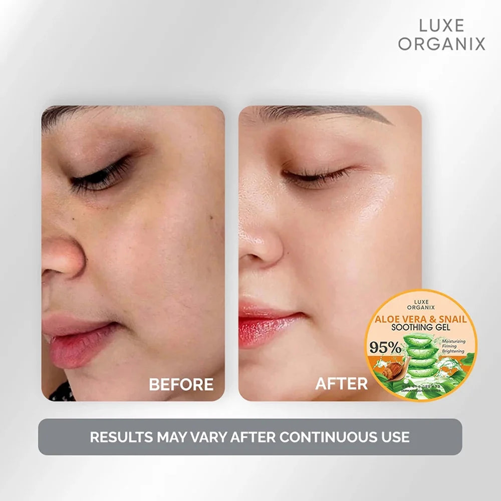 Luxe Organix Aloe Vera & Snail Soothing Gel 300ml