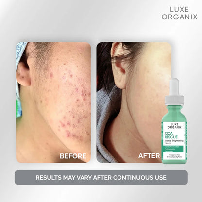Luxe Organix Cica Rescue Gentle Brightening Serum